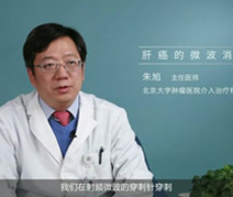 肝癌的微波消融技术